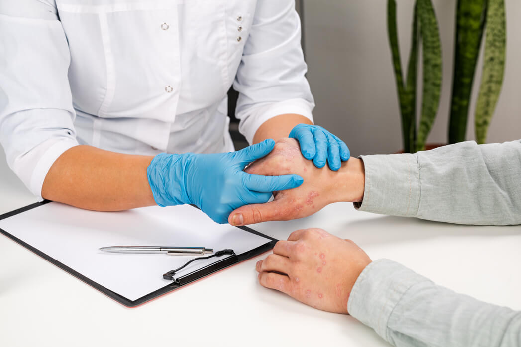 avanguardia poliambulatorio_dermatologia_psoriasi